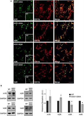 Histamine Regulates the Inflammatory Profile of SOD1-G93A Microglia and the Histaminergic System Is Dysregulated in Amyotrophic Lateral Sclerosis